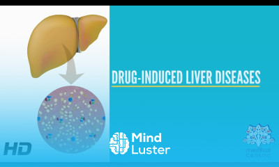 Drug Induced Liver Disease Causes Signs and Symptoms Diagnosis and Treatment