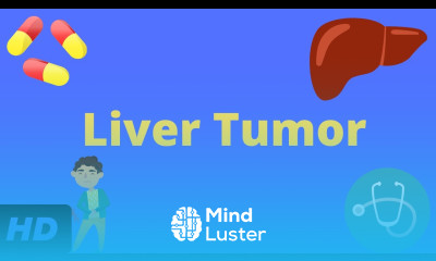 Liver Tumor Causes Signs and Symptoms Diagnosis and Treatment