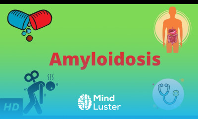 Amyloidosis Causes Signs and Symptoms Diagnosis and Treatment