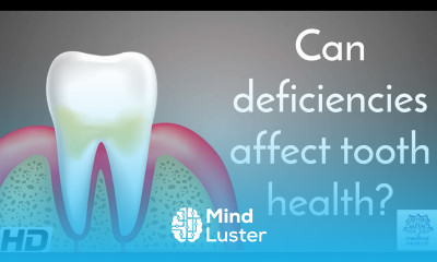 Can Deficiencies Affect Tooth Health
