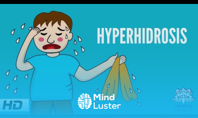 Hyperhidrosis Causes Signs and Symptoms Diagnosis and Treatment