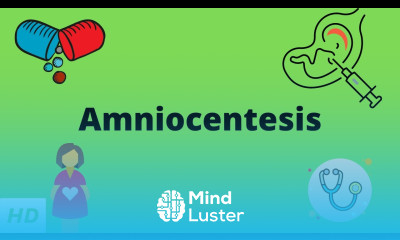 Amniocentesis Causes Signs and Symptoms Diagnosis and Treatment
