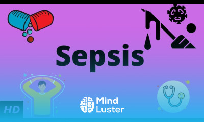 Sepsis Everything You Need to Know