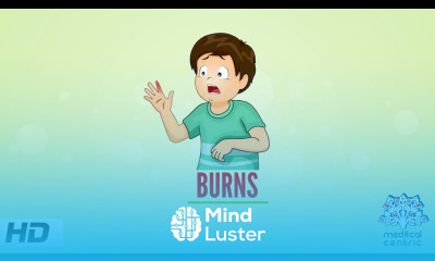 Burns Causes Signs and Symptoms Diagnosis and Treatment