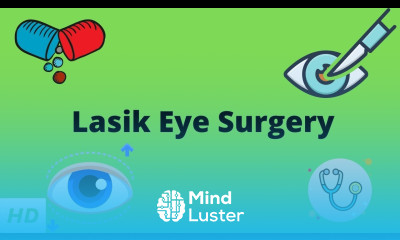 Lasik Eye Surgery Everything You Need to Know
