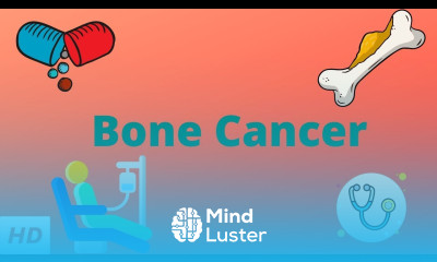 Bone Cancer Causes Signs and Symptoms Diagnosis and Treatment