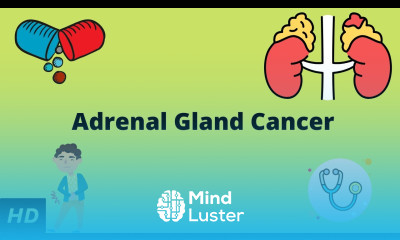 Adrenal Gland Cancer Causes Symptoms Diagnosis and Treatment