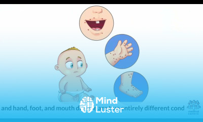 What is Chemotherapy Hand Foot Syndrome