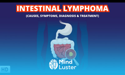 The Silent Killer Understanding Intestinal LymphomaIntestinal Lymphoma