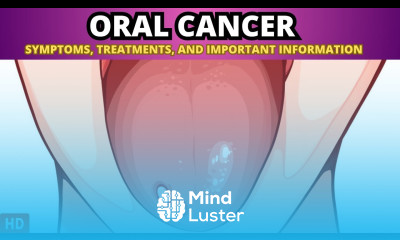Oral Cancer Causes Symptoms and Prevention