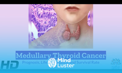Navigating Medullary Thyroid Cancer Prognosis Unveiled