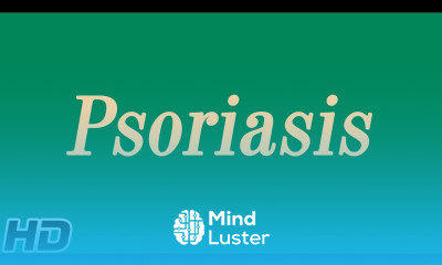 Psoriasis Causes Types Sign and Symptoms Diagnosis and Treatment
