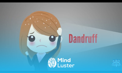 Dandruff Causes Signs and Symptoms Diagnosis and Treatment