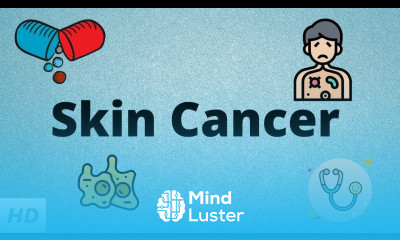 Skin Cancer Causes Signs and Symptoms Diagnosis and Treatment