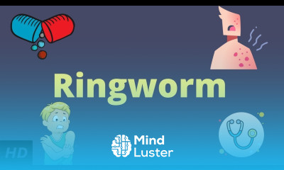 Ringworm Causes Signs and Symptoms Diagnosis and Treatment