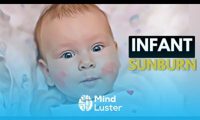 How To Prevent and Treat Infant Sunburn