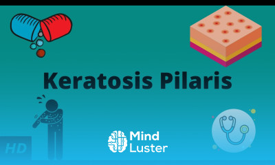 Keratosis Pilaris Causes Signs and Symptoms Diagnosis and Treatment