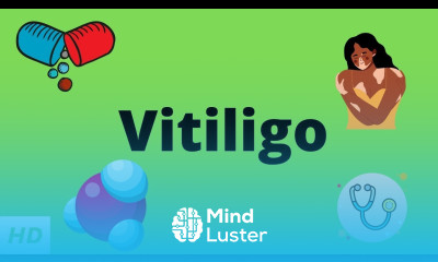 Vitiligo Causes Signs and Symptoms Diagnosis and Treatment