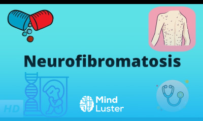 Neurofibromatosis Causes Signs and Symptoms Diagnosis and Treatment
