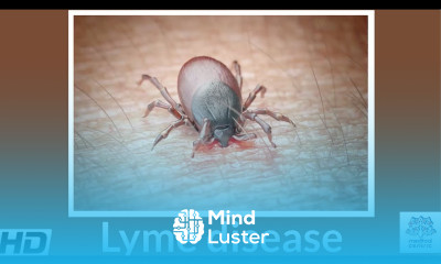Lyme Disease Causes Signs and Symptoms DIagnosis and Treatment
