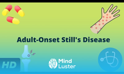 Adult Onset Still s Disease Causes Symptoms And Treatment