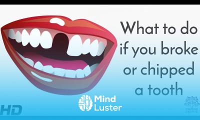 What To Do If You Broke Or Chipped A Tooth