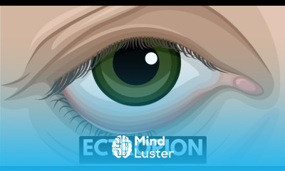 Ectropion Causes Symptoms Complications And Treatment