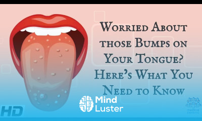 Worried About Those Bumps on Your Tongue Here s What You Need To Know