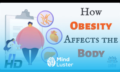 Learn The Heavy Burden of Obesity Understanding its Effects on Your ...