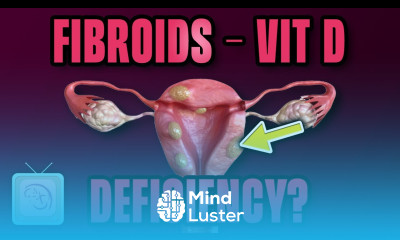 Is Vitamin D a Fibroid Cure