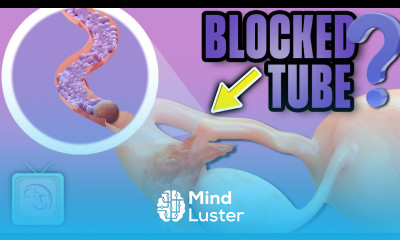 Is IVF your only option for blocked tubes