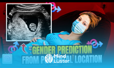 Can you predict your baby s sex with The Ramzi Theory placenta location
