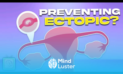 How to reduce your risk for ectopic pregnancy