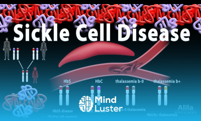 Sickle Cell Disease Animation