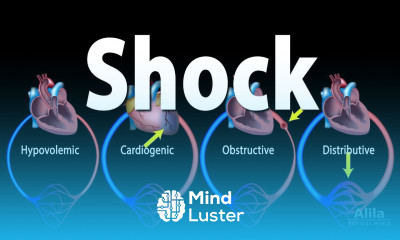 Shock Pathology of Different Types Animation