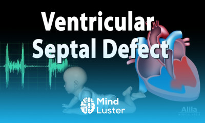 Ventricular Septal Defect Animation