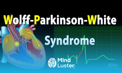 Wolff Parkinson White Syndrome Pathophysiology Pre Excitation and AVRT Animation