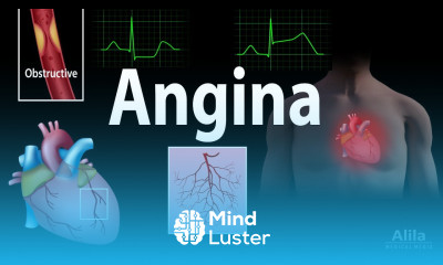 Angina Stable Unstable Microvascular and Prinzmetal Animation