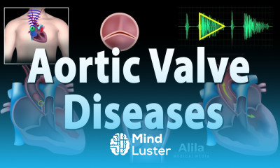 Aortic Valve Disease Animation