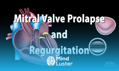 Mitral Valve Prolapse and Regurgitation Animation