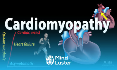 Cardiomyopathy animation