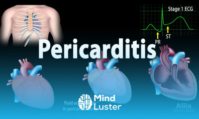 Pericarditis Symptoms Pathophysiology Causes Diagnosis and Treatments Animation