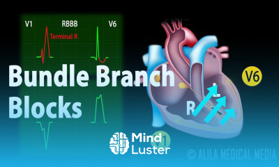 Bundle Branch Block Animation