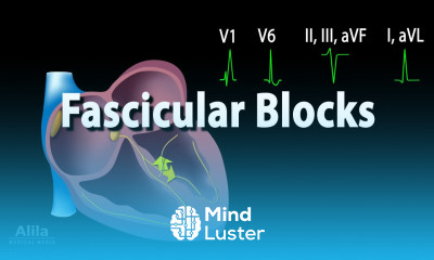 Fascicular Blocks Animation