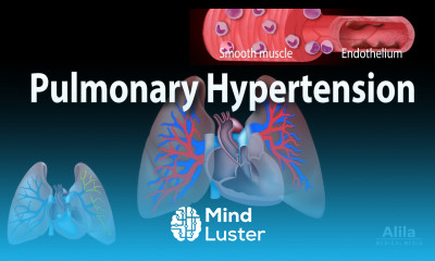 Pulmonary Hypertension Animation