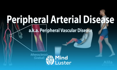 Peripheral artery disease Pathophysiology Causes Symptoms Diagnosis and Treatments Animation