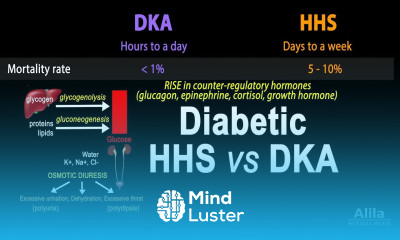 Hyperosmolar Hyperglycemic State Diabetic HHS vs DKA Animation