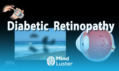 Retinopathy Diabetic and Hypertensive Animation
