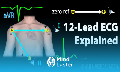 12 Lead ECG Explained Animation