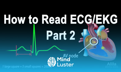 How to Read ECG EKG Part 2 Animation